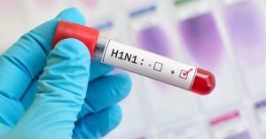 Omumu los casos respiratorios en hospitales del país