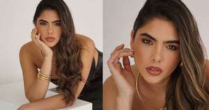 La Nación / Modelo cuestionó el relleno de labios: “Este retoque se está yendo de las manos”