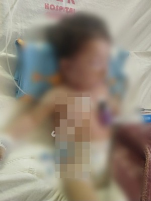 Madre denuncia que su bebé fue quemado con estufa en Hospital Central del IPS