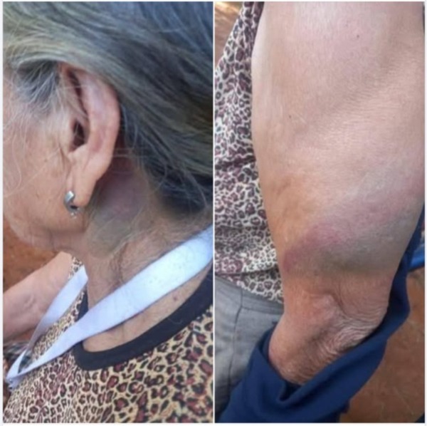 Yaguarón: mujer denuncia a su propia hija por golpearla con una varilla e intentar estrangularla