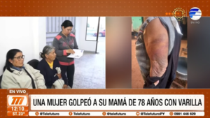 Una mujer golpeó a su mamá de 78 años con una varilla