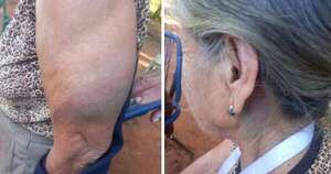 La Nación / Mujer de 78 años fue brutalmente golpeada por su hija en Yaguarón