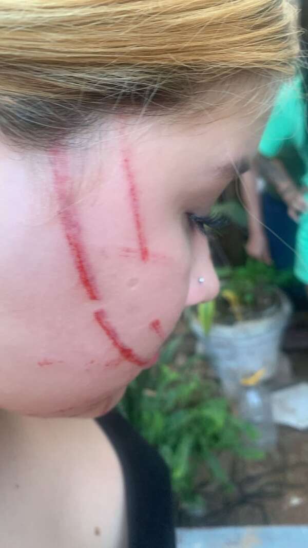 Madre denuncia brutal agresión a su hija con participación de adultos - Policiales - ABC Color