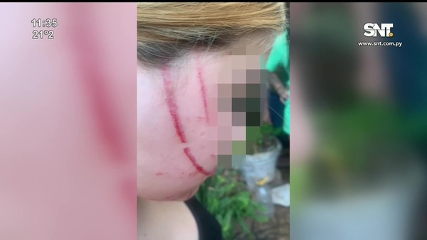 Menor fue agredida por otra adolescente y dos adultos en Barrio Obrero - SNT