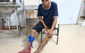 Baleado por su propio hermano
