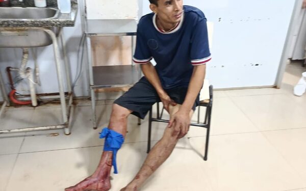 Baleado por su propio hermano