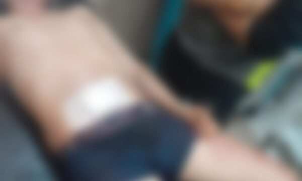 Apuñalan a un hombre en el Km 11 Monday