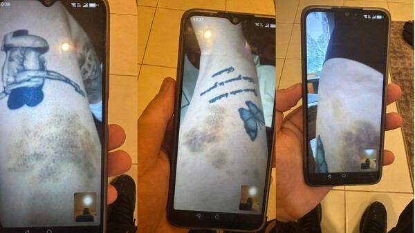 Esposa de Marset muestra lesiones y abogado pide atención médica adecuada