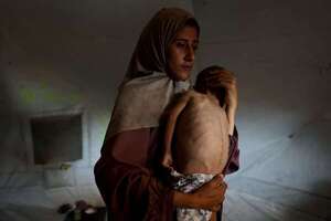 MSF: 25 % de niños y embarazadas de Gaza, desnutridos por “política del hambre” israelí - Mundo - ABC Color