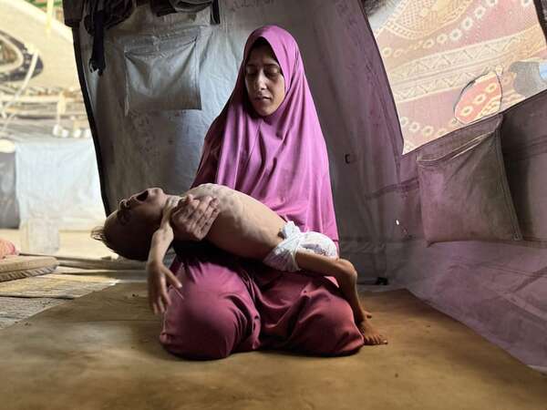Gaza: desnutrición mata a cinco personas, incluido un bebe y dos niños, en las últimas 24 horas - Mundo - ABC Color