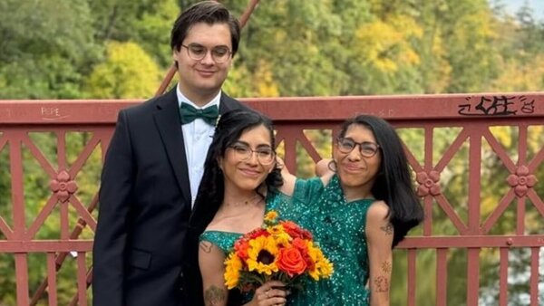 La historia de la siamesa que se casó con autorización de su gemela