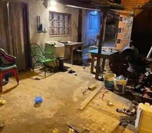 Mujer terminó con graves quemaduras tras discusión con su pareja