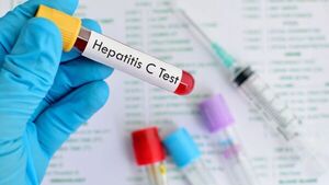Hepatitis B y C: Sepa más sobre la enfermedad que afecta a más de 860 personas