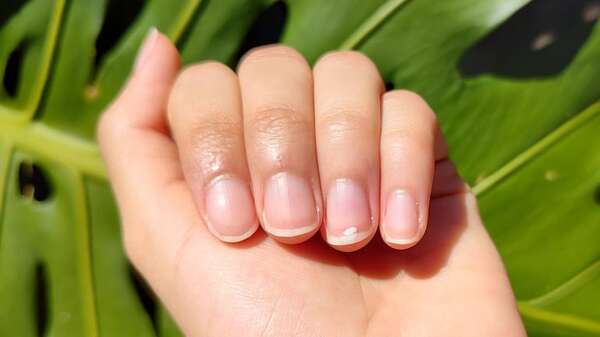 Lo que tus uñas, lengua y piel dicen de tu salud sin que lo notes - Estilo de vida - ABC Color