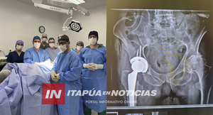 HOSPITAL GENERAL DE ITAPÚA REALIZA CON ÉXITO CIRUGÍA DE CADERA