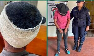 Popular / Karai tuvo que ser auxiliado tras ser agredido por su pareja con una ¡olla de hierro!