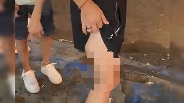 Bodega hizo "descuento" a hinchas que ligaron "más balines de goma"