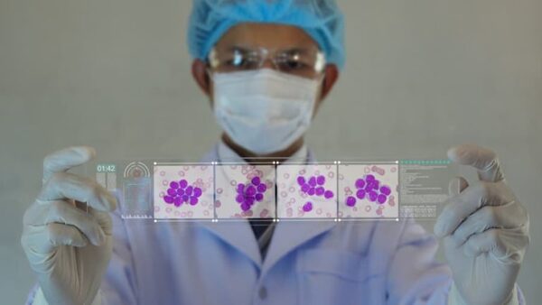 Nuevas terapias brindan esperanzas a pacientes con Leucemia Mieloide Aguda