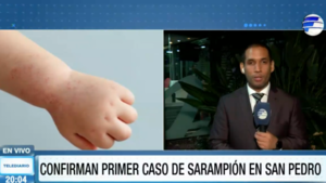 Confirman primer caso de Sarampión en Paraguay