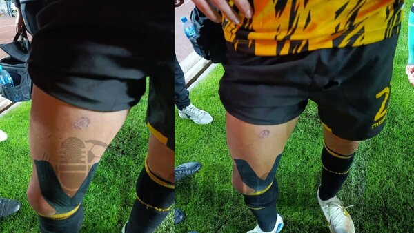 Paraguayo Godoy es herido por bengala