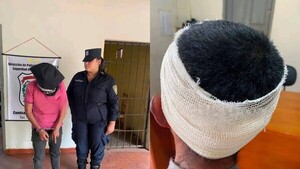 No quería escuchar el clásico: la razón por la que mujer reventó la cabeza a su novio con olla de hierro