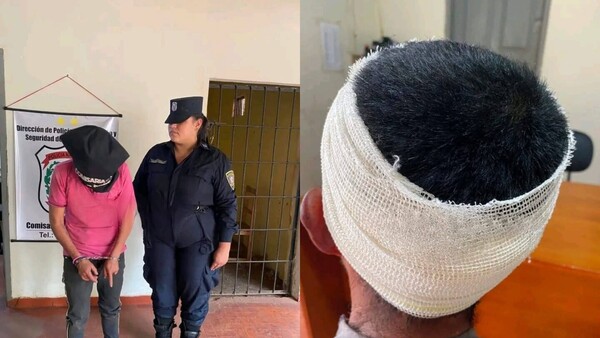 No quería escuchar el clásico: la razón por la que mujer reventó la cabeza a su novio con olla de hierro