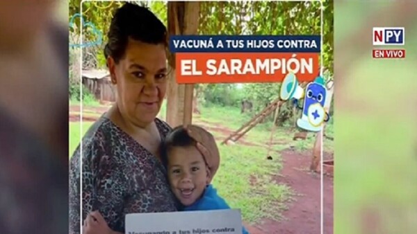 Confirman el primer caso de sarampión en San Pedro