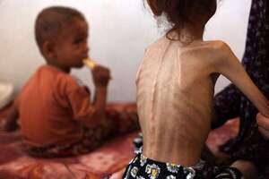 Gaza registra cinco nuevas muertes por desnutrición, incluido un bebé - Mundo - ABC Color