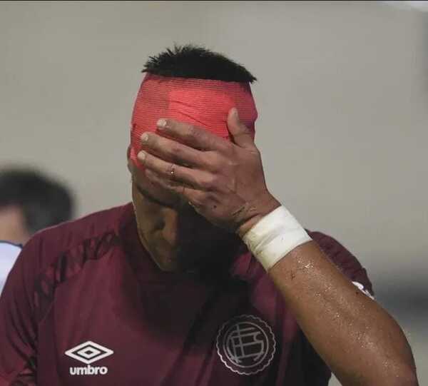 Popular / Pelotero paraguayo sufrió fractura de cráneo en pleno partido: “Está evolucionando”