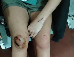 Conductor reincidente dejó heridos y no asumió responsabilidad