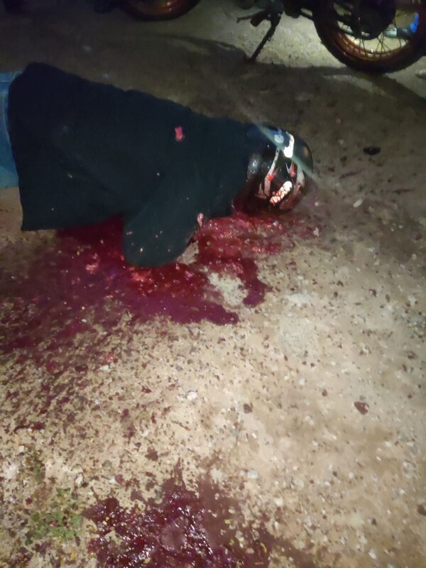Popular / Atentado en PJC: a balazos sicarios le desfiguraron el rostro y otro quedó herido