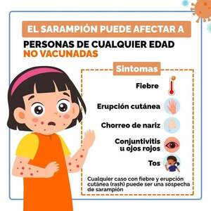 Ministerio de Salud emitió alerta epidemiológica ante el brote del sarampión