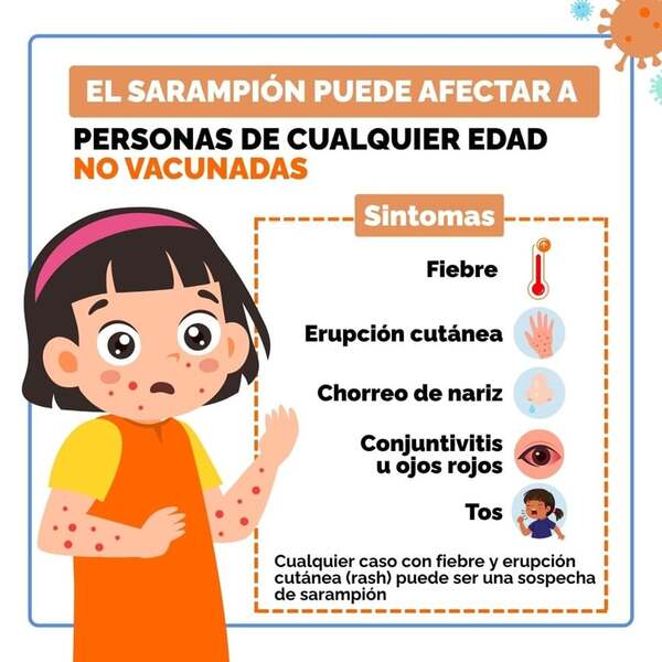Ministerio de Salud emitió alerta epidemiológica ante el brote del sarampión