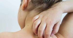 La Nación / Salud emite alerta epidemiológica luego de confirmarse tres casos más de la enfermedad