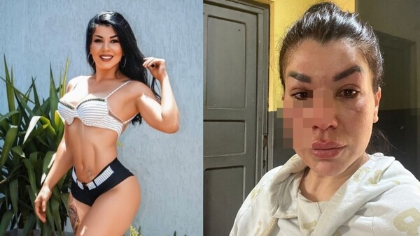 La modelo Dalila Argaña denunció que fue garroteada por defender a un michi