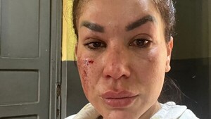 Limpio: Voluntaria denuncia agresión por la dueña de un perro, tras intentar defender a un gato