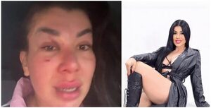 Popular / (VIDEO) ¡Modelo quedó desfigurada por querer salvar a un gatito!