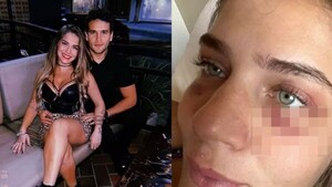 Brasileña denunció a Jorge Báez y dijo que perdió una bendi tras la garroteada
