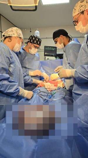 Tumor de casi ocho kilos es extirpado a una embarazada en el IPS - Nacionales - ABC Color