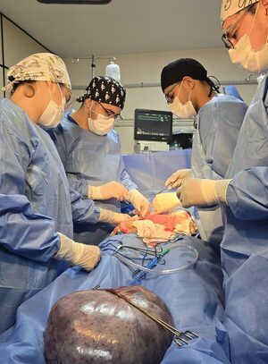 Hospital Central del IPS extirpa quiste de casi 8 kilos a embarazada de 31 semanas - .::Agencia IP::.