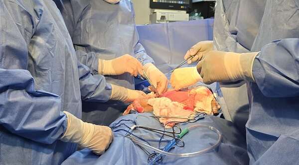 Exitosa cirugía en el IPS: extirpan tumor gigante de 8 kilos a mujer embarazada de 31 semanas