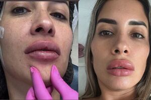 Popular / "Abejita" pidió que "paren de juzgar" a las que se mandan hacer retoques