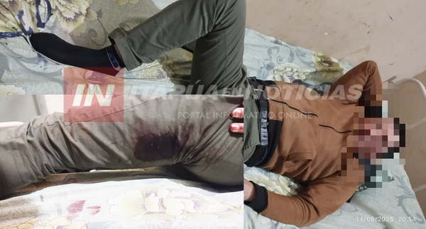 ALTO VERÁ: HOMBRE SE DISPARÓ ACCIDENTALMENTE EN LA PIERNA