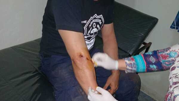 Policía y detenido resultan heridos tras tiroteo en Alto Paraná