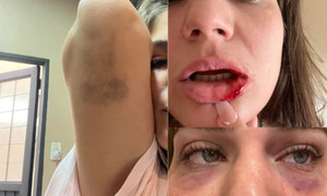 Brasileña rompe el silencio y denuncia años de violencia del ex futbolista paraguayo Jorge Báez - OviedoPress