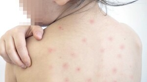 En San Pedro piden libreta de vacunación en escuelas y coles