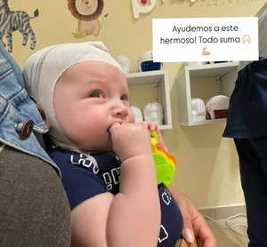 Madre pide ayuda para conseguir un casco para su hijo con plagiocefalia postural