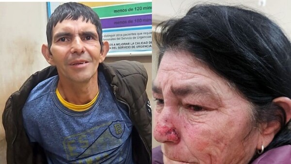 Se puso "nervioso" e intentó asesinar a su propia mamá