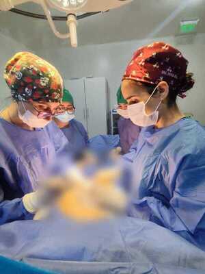 Popular / Extraen feroz tumor de 8 kilos del ovario de una péndex de 20 años