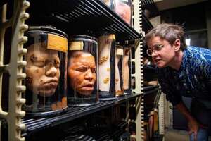 Fascinación y controversia en la historia médica del Mütter Museum - Ciencia - ABC Color